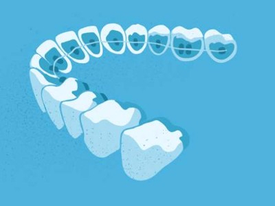 惟德口腔醫(yī)院口腔正畸好不好？