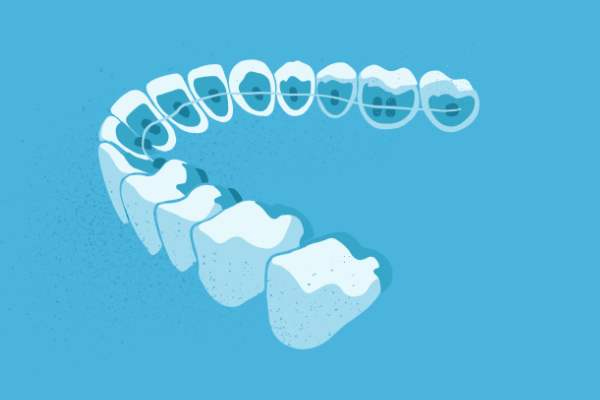 惟德口腔醫(yī)院口腔正畸好不好？